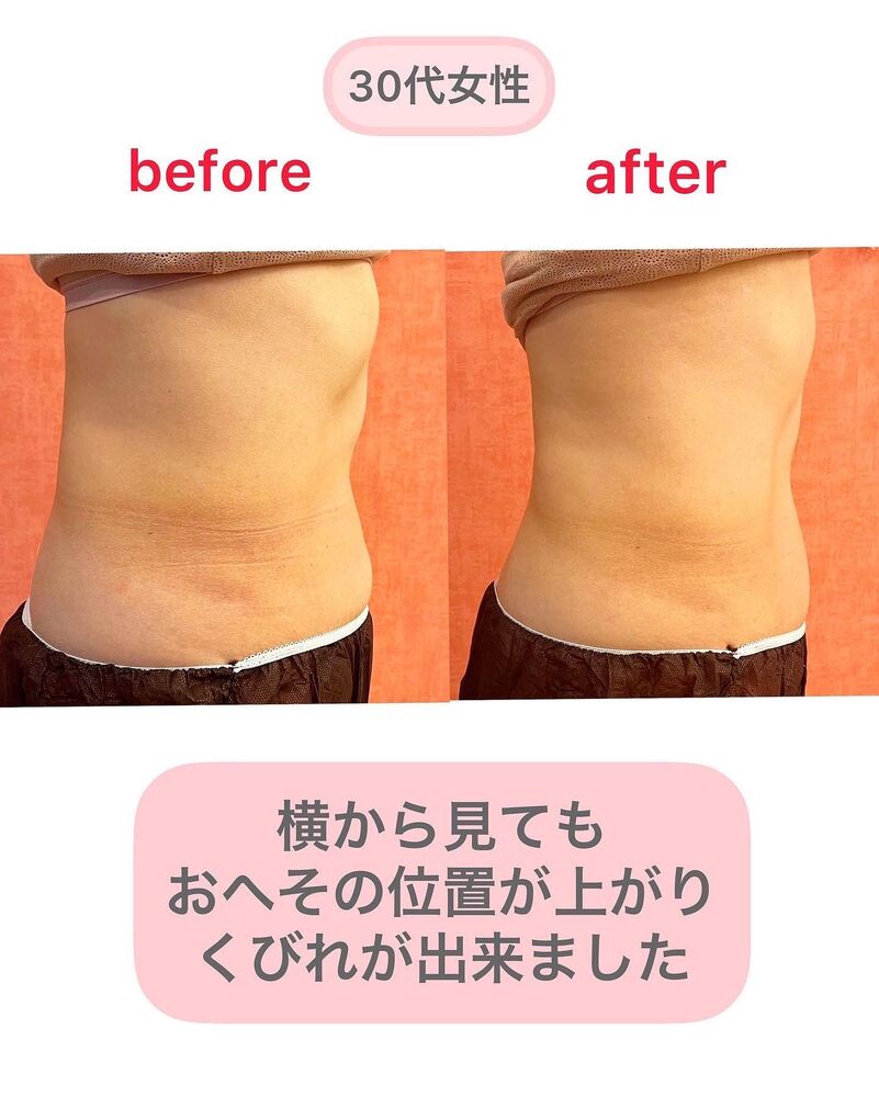 画像1475