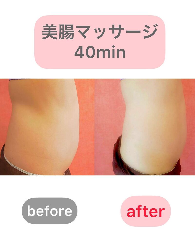 画像1515